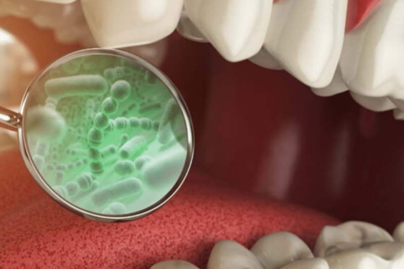 Blick in das Innere des Mundes