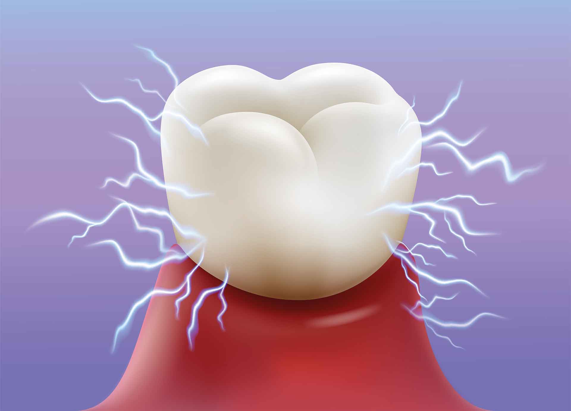 Zahnfüllung verloren