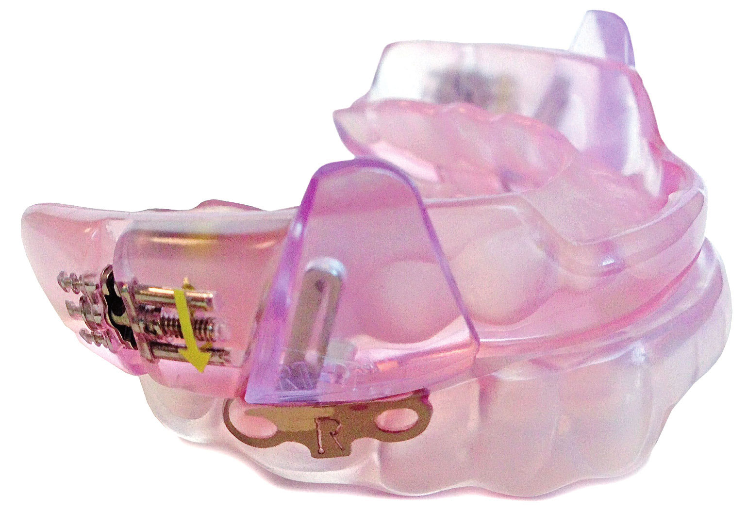 SomnoDent Fusion Schnarchschiene — individuell angepasste Unterkieferprotrusionsschiene