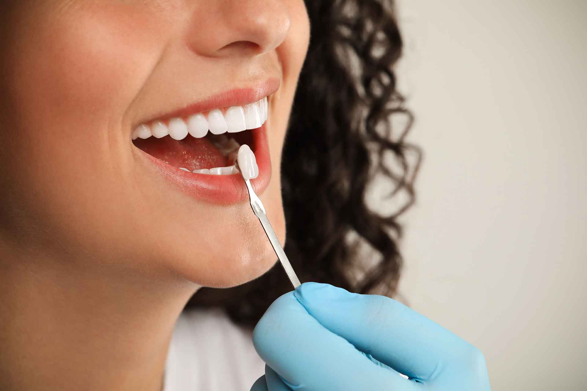 Veneers zur ästhetischen Behandlung eines Diastemas